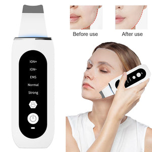 Eaiser Facial Pore Cleaner Ultrasonic Skin Scrubber Deep Face Cleaning Ultrasonic Ion Ance Pore Cleaner Peeling Blackhead Remover