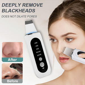 Eaiser Skin Scrubber Ultrasound Vibration Massager Portable Facial Pore Cleaner Peeling Blackhead Remover Deep Face Cleaning Machine